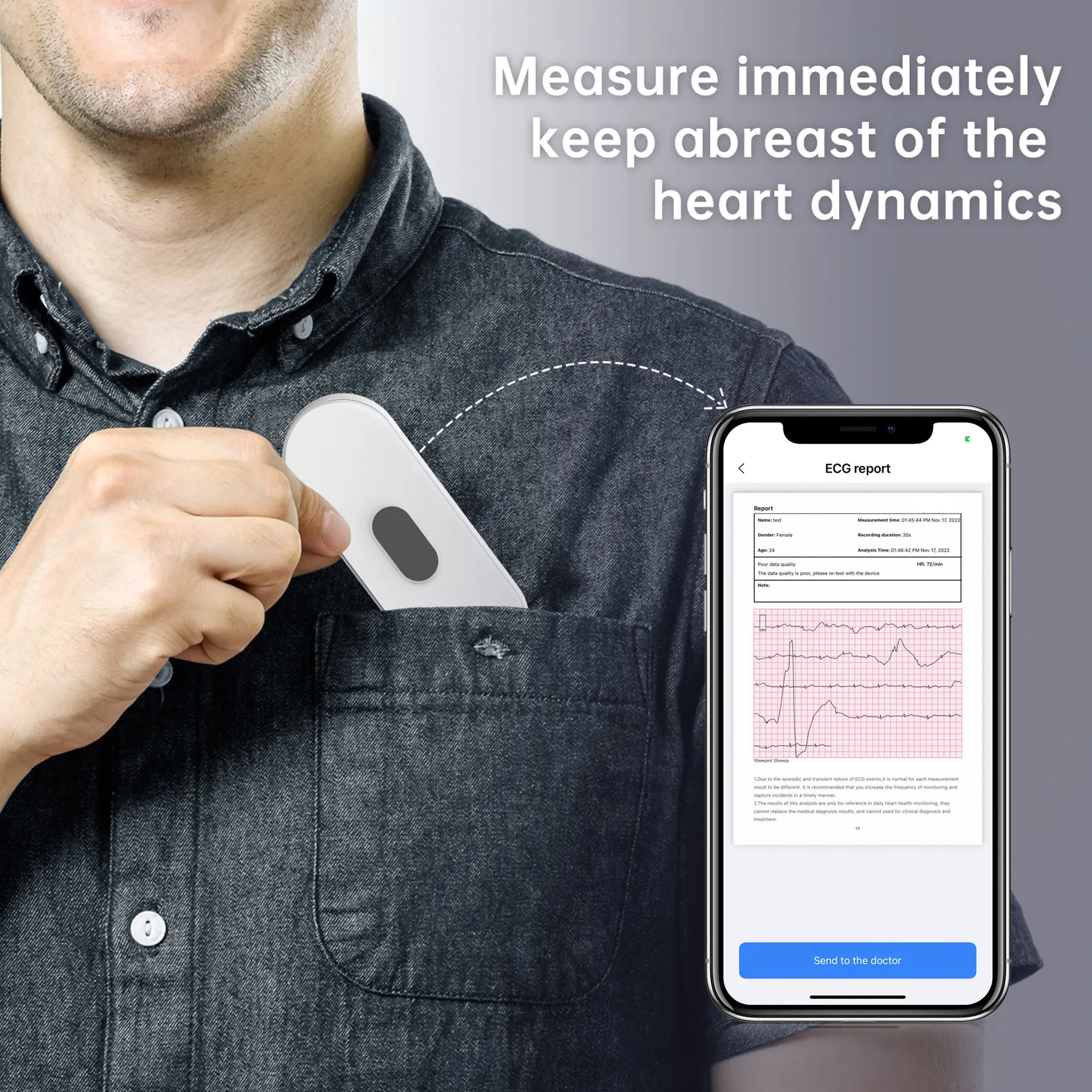 Checkme DuoEK S ECG Monitor