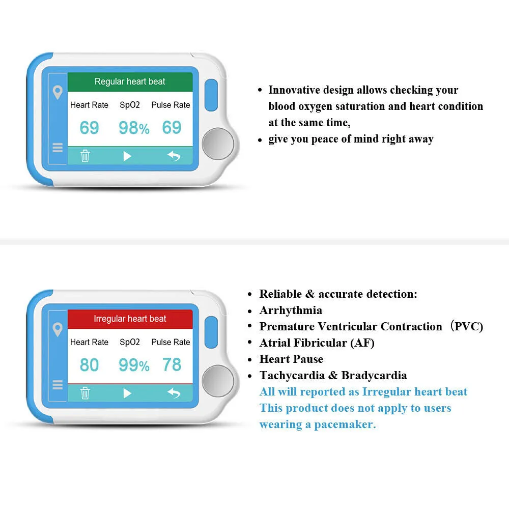 Pulsebit Mate Plus Home ECG Monitor