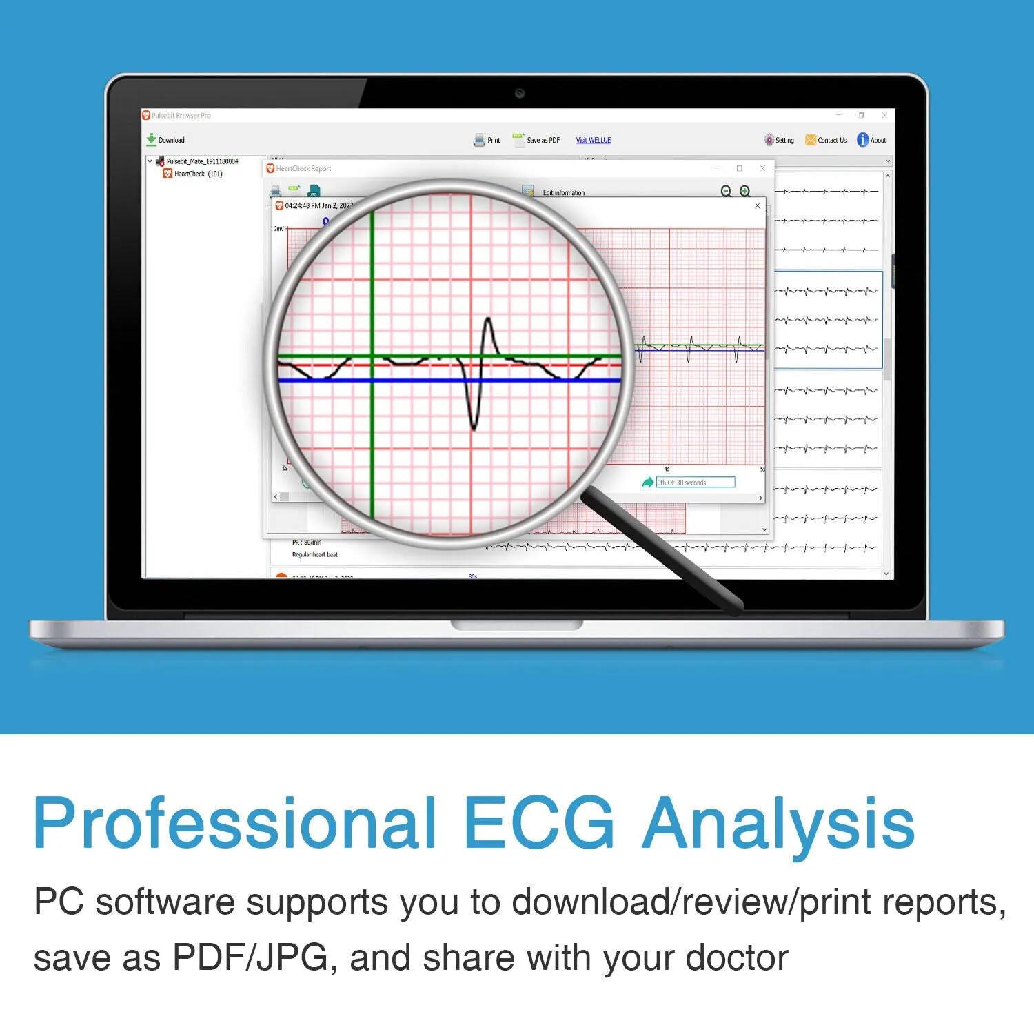 Pulsebit Mate Plus Home ECG Monitor